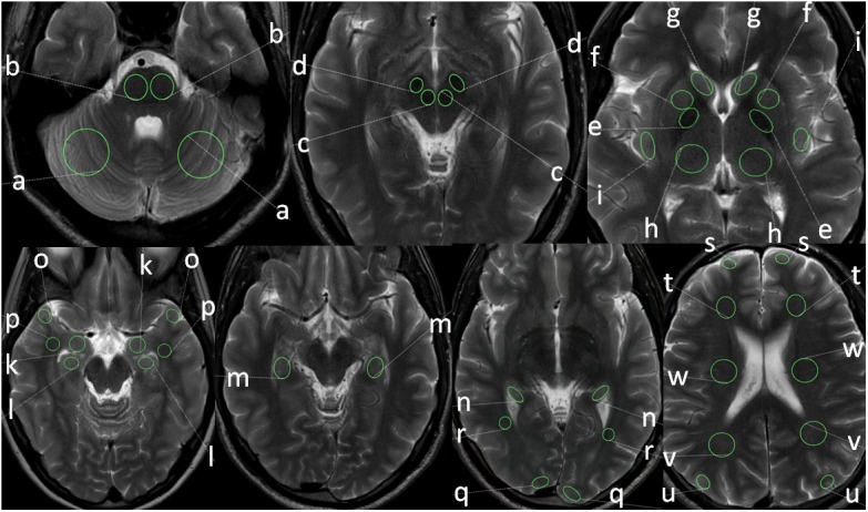 FIGURE 2