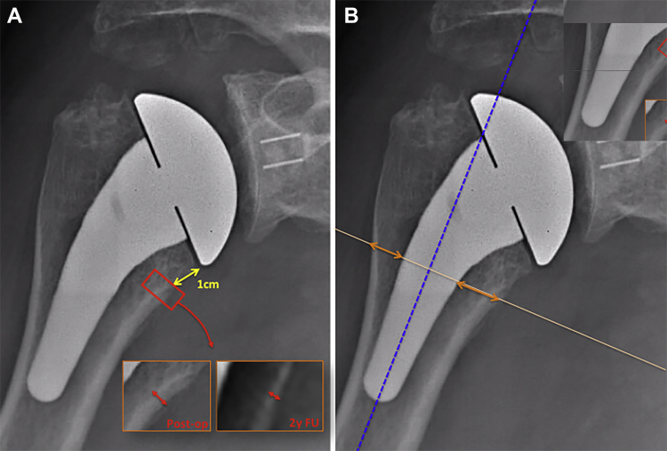 Figure 4