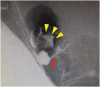 Fig. 3
