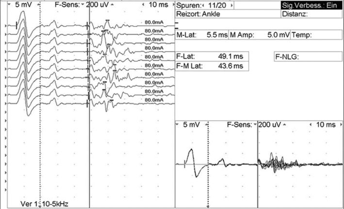 FIGURE 2