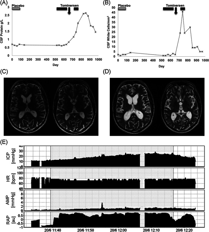 FIG. 1.