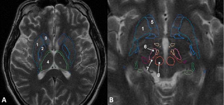 Fig 2