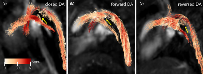 FIGURE 3