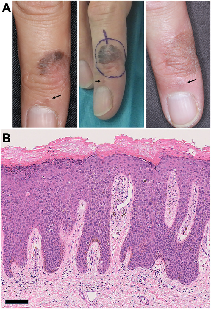 FIGURE 1