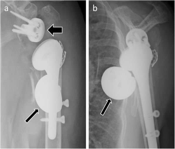 Fig. 11