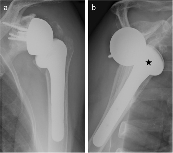 Fig. 12