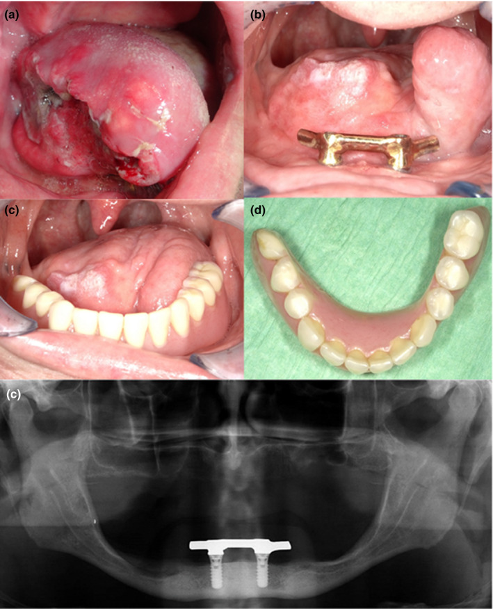 FIGURE 2