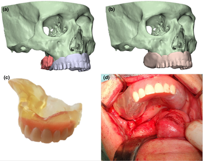 FIGURE 3