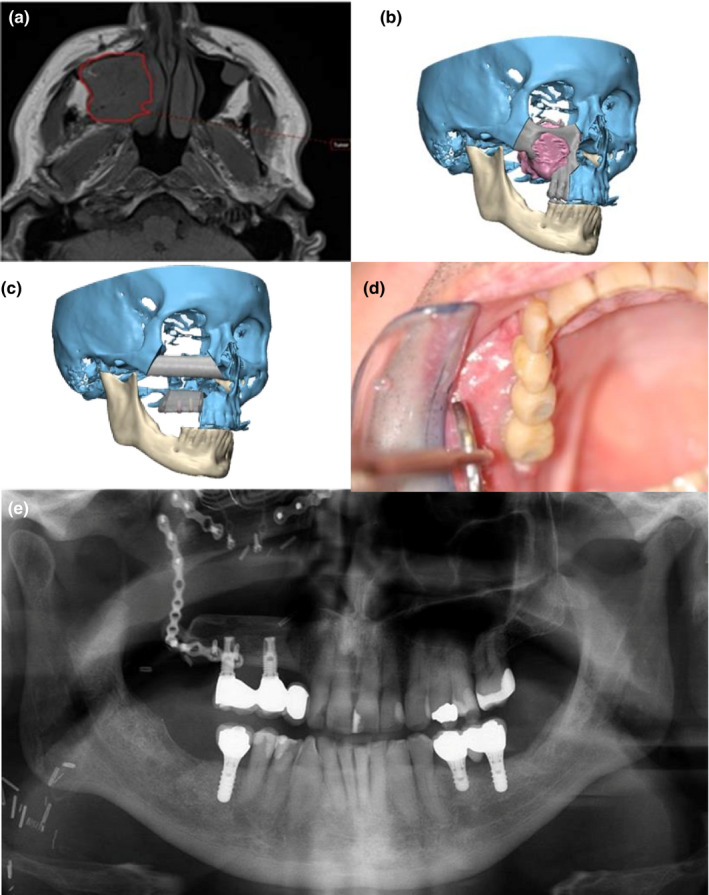 FIGURE 4