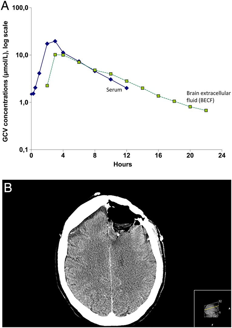 Figure 1