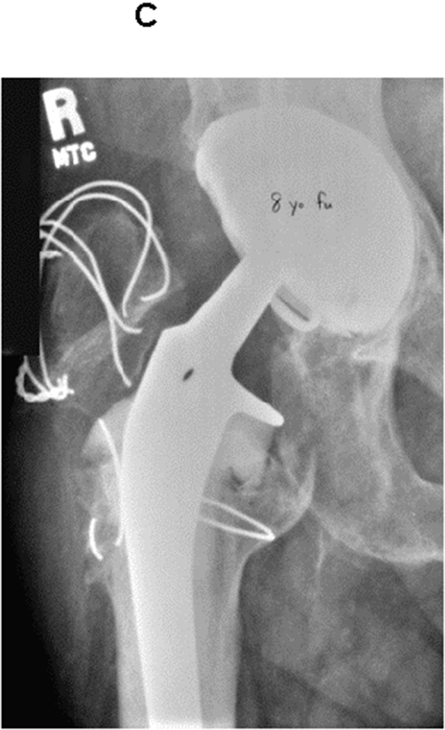 Figure 3A through C.