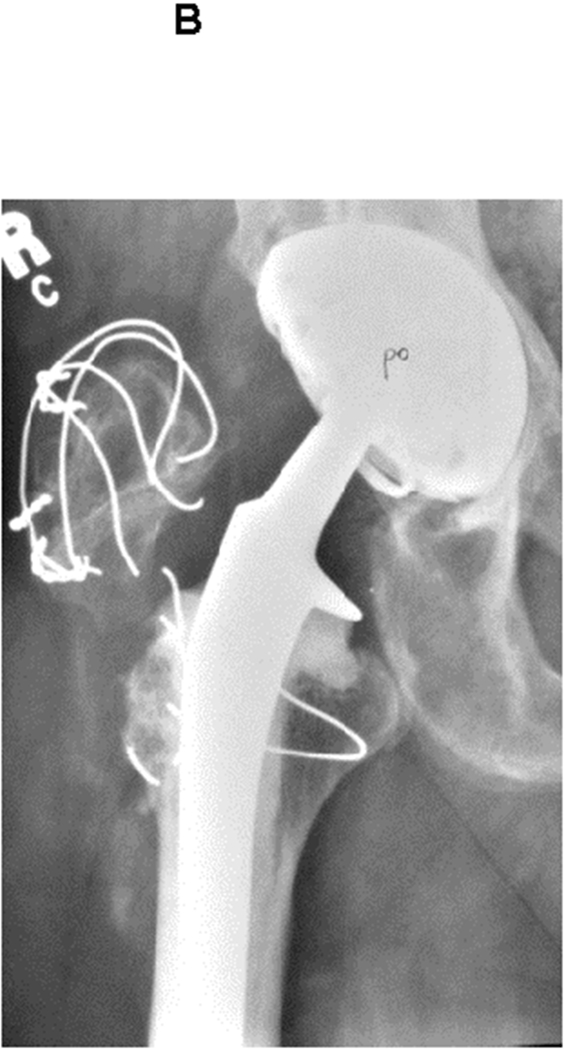 Figure 3A through C.