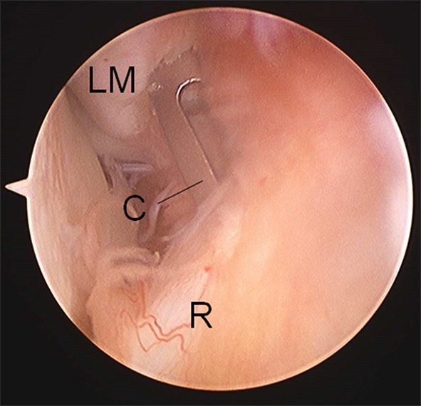 Fig. 2