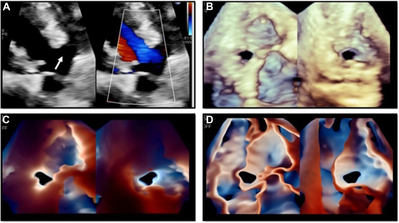 Figure 1