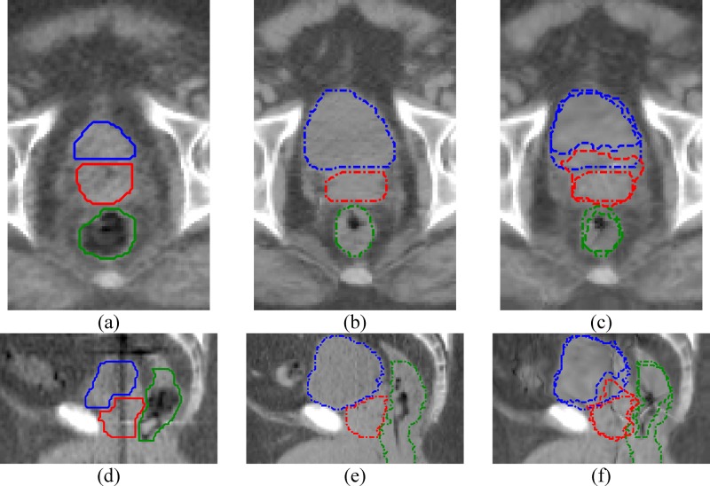 FIG. 2.