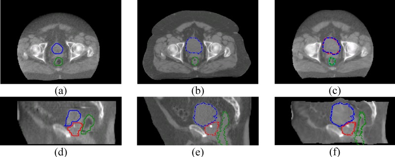 FIG. 5.