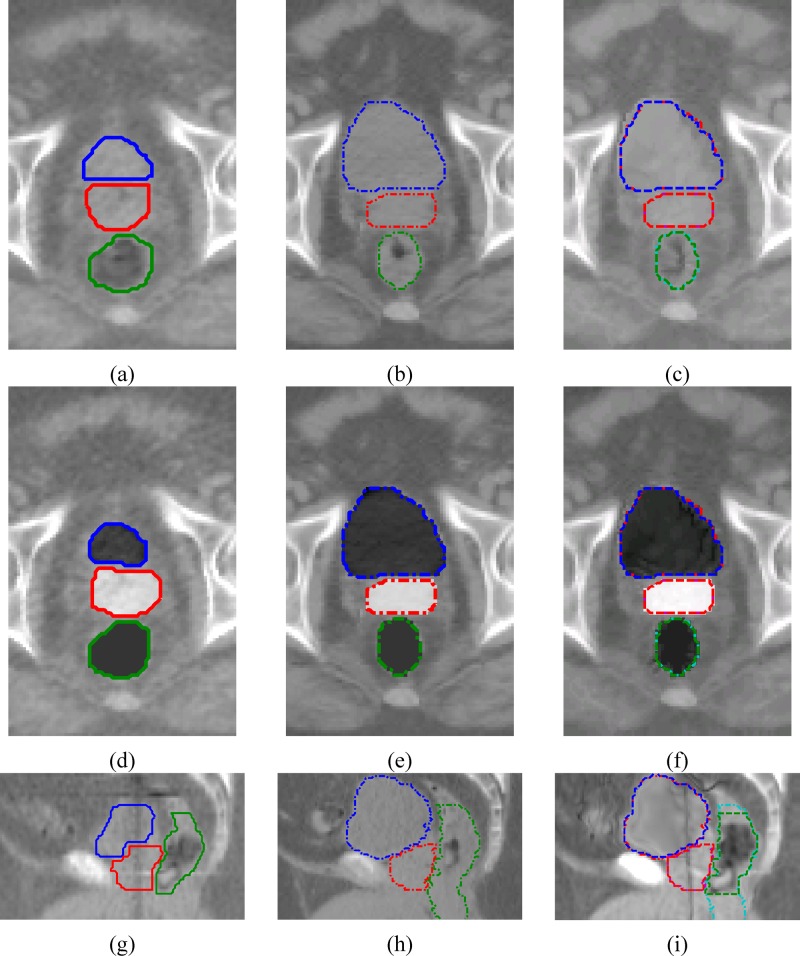 FIG. 4.