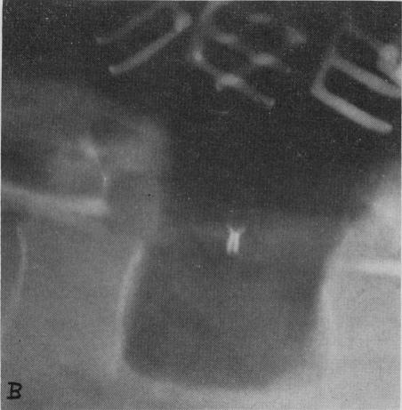 Fig. 10b