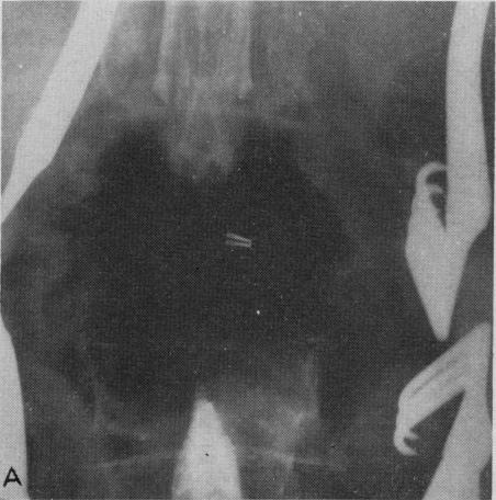 Fig. 10a