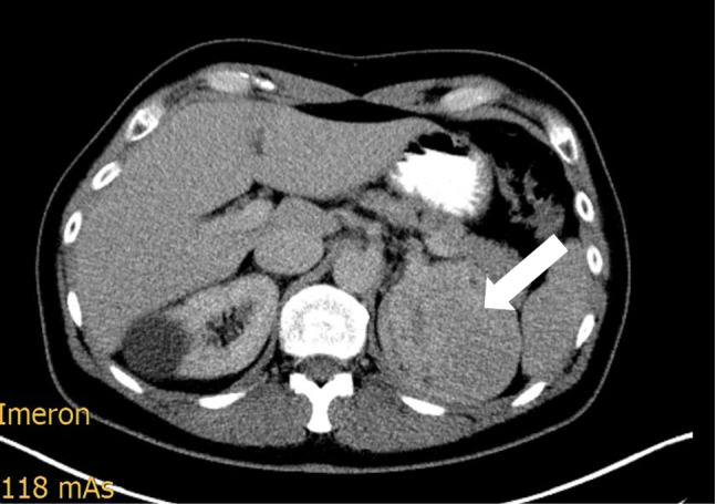 Fig. 1