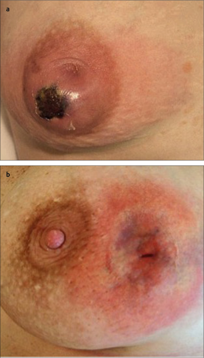 Figure 5. a, b