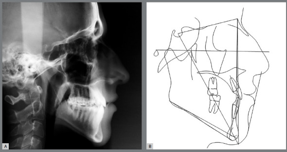 Figure 3: