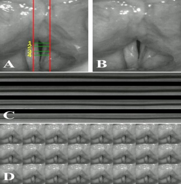 Fig2