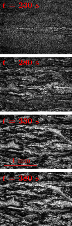 Example blood flow images from the 100 mM CaCl2 case at t=230−380 s at intervals of 50 s, showing the development of coagulation. Flow is from left to right. The flow has coagulated in the dark regions of the bottom three images. The images have been preprocessed using the steps described in the text. The horizontal line in the lower left of the image at t = 330 s indicates the scale (1 mm).