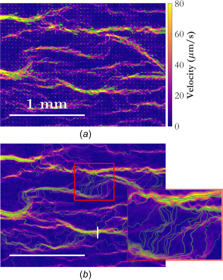 Instantaneous snapshots of the velocity field at t = 330 s for wOFV showing (a) velocity vectors and (b) streamlines, each shown in green. The velocity field is colored according to velocity magnitude. Velocity vectors are subsampled by a factor of 30 in both dimensions and scaled by a factor of 20 to aid in visualization. The transparency for each streamline is set according to the mean residence time along that streamline, with more transparency indicating a longer residence time (lower average velocity). The vertical white line in (b) is referenced in Fig. 7. The horizontal white lines indicate the spatial scale. A zoomed-in image of the region marked by a red rectangle in (b) shows the streamlines in finer detail.