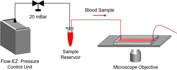 Schematic view of the experimental setup. A pressure control unit was utilized to inject the blood sample into the microfluidic channel at a constant pressure of 20 mBar. The microfluidic channel was placed on an inverted microscope, and the blood flow was recorded under 4X magnification using a high-resolution microscope camera.