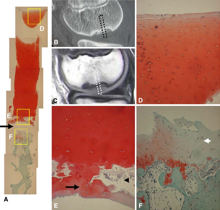 Fig. 3A–F