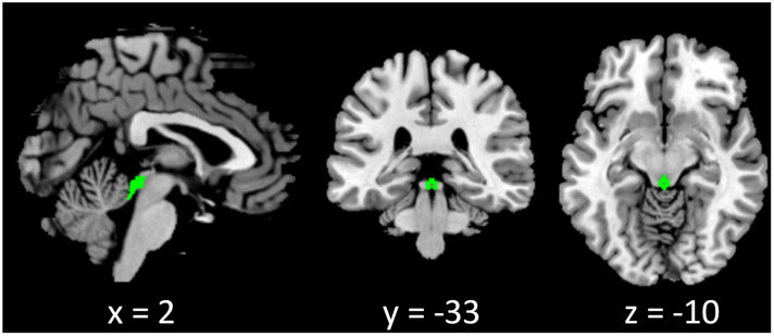 FIGURE 1