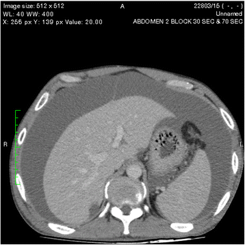 Fig. 9