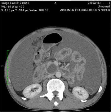 Fig. 2