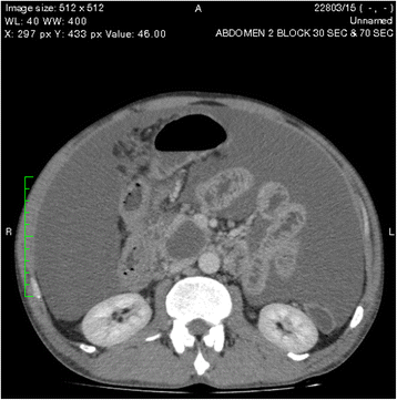 Fig. 4