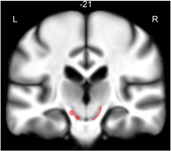 Fig. 2