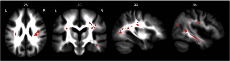 Fig. 4