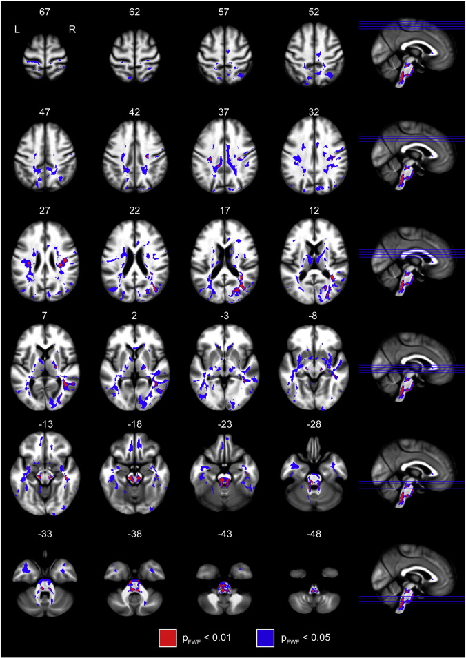 Fig. 1