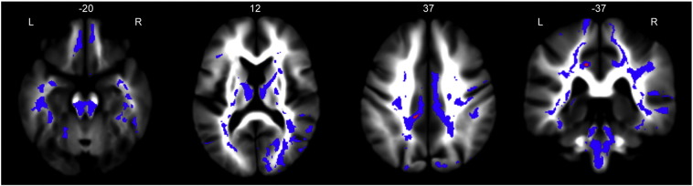 Fig. 3