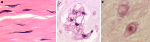 Fig. 1