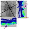 Fig. 4