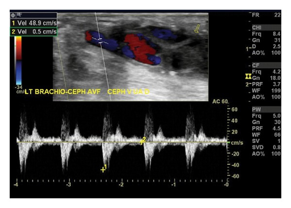 Figure 6