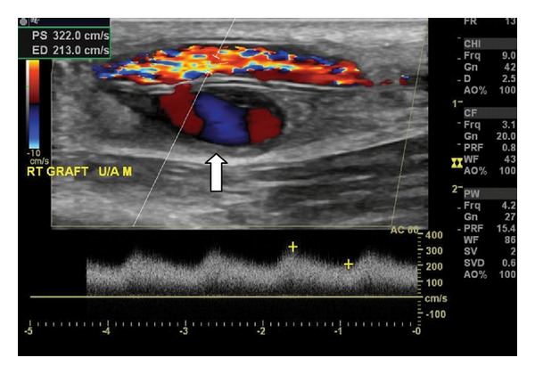 Figure 9