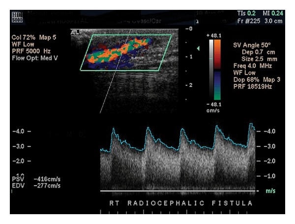 Figure 4