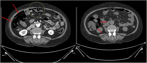 Fig. 2