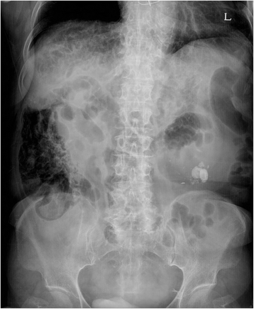 Fig. 1
