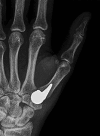 Fig. 2