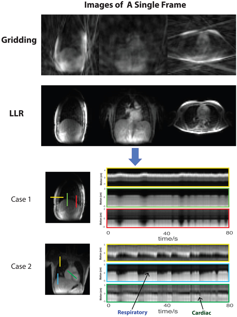 FIG. 2.