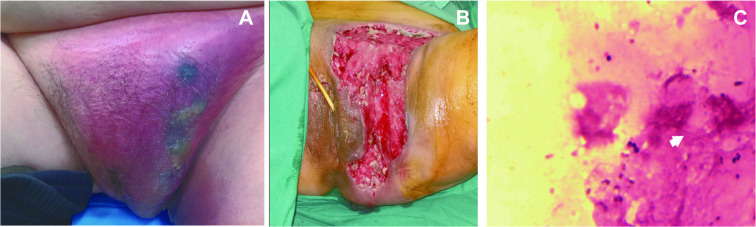 Fig. 1