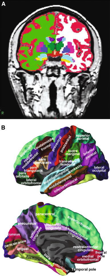 Fig. 1